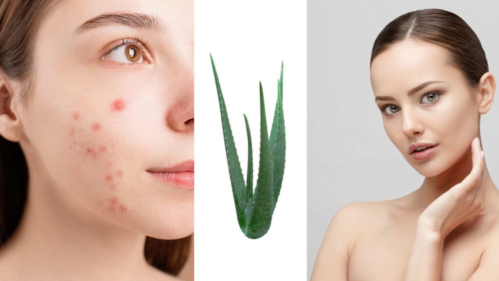 How to Make Aloe Vera Face Pack?